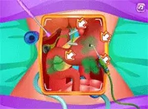 Princess Gallbladder Surgery Online Game